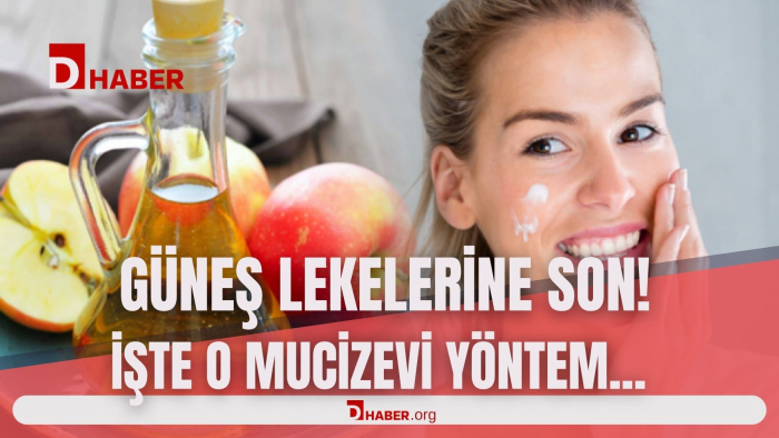 GÜNEŞ LEKELERİNE SON ! İŞTE O MUCİZEVİ YÖNTEM !
